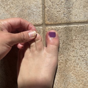 L A Nail Studio - Update- keeps getting worse and more painful. - Nail Salons Near Me - Exton, Pennsylvania