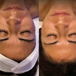 Sana Blue Med Spa