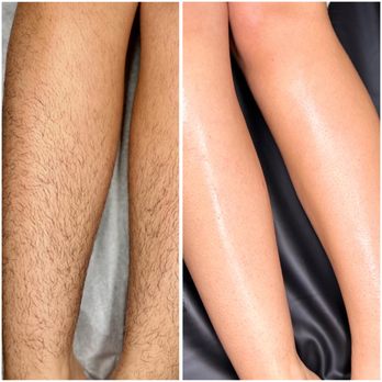 Casa de Wax - Before and After with HARD WAX!! - Waxing Near Me Casa de Wax - Before and After with HARD WAX!! - Waxing Near Me