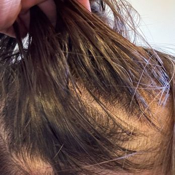 I Massage & Wax - Nonstop hair loss since visiting IMassage - Massage Near Me - Pasadena, California I Massage & Wax - Nonstop hair loss since visiting IMassage - Massage Near Me - Pasadena, California