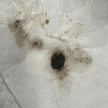 Sardi's Pollo A La Brasa - Dirty hair ball found in food - Peruvian Near Me - Laurel, Maryland Sardi's Pollo A La Brasa - Dirty hair ball found in food - Peruvian Near Me - Laurel, Maryland