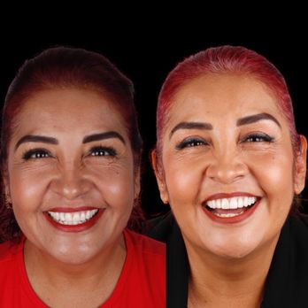 DEO Clinic - Diseño de sonrisa - Oral Surgeons Near Me - Guadalajara, JAL