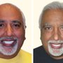 Photo of Baldev Sandhu, MD