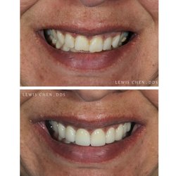 Advanced Dental Group