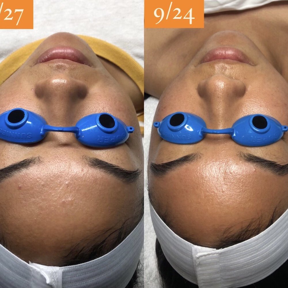 Skin with Robin - Skin Care Near Me - Long Beach, California Skin with Robin - Skin Care Near Me - Long Beach, California