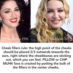 Cynthia Lopez, MD - Beware of puffy cheeks. We follow the golden ratio to create perfect, sensational looking cheeks.