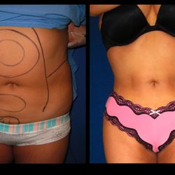 West Hills Plastic Surgery