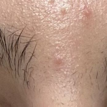 Eyebrow Land - Before service - Eyebrow Services Near Me - Columbia, Maryland
