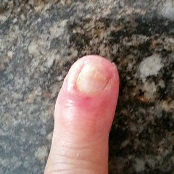 Dreamy Nails & Spa - Dreamy Nails will send you to Urgent Care. - Nail Salons Near Me - Ramona, California Dreamy Nails & Spa - Dreamy Nails will send you to Urgent Care. - Nail Salons Near Me - Ramona, California