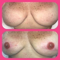 Angel Art - 3D Areola Tattoos