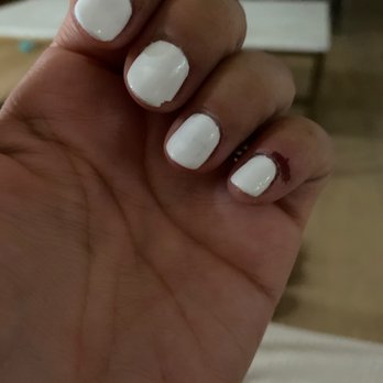 Milan Nails - Chipping and pinky has a cuticle wound - Nail Salons Near Me - Rolling Hills Estates, California Milan Nails - Chipping and pinky has a cuticle wound - Nail Salons Near Me - Rolling Hills Estates, California