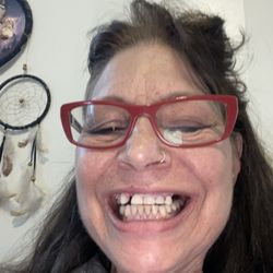 Princessa Dental - A disgusting looking smile