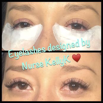 United Nurses Medi Spa - Medical Spas Near Me
