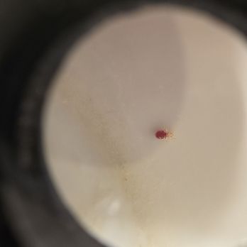 Ironworks Hotel - Bed bug nymph, imaged through magnifying loupe, room 412, December 27, 2025. - Hotels Near Me - Beloit, Wisconsin