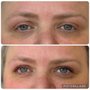 Photo of Limelight Lash