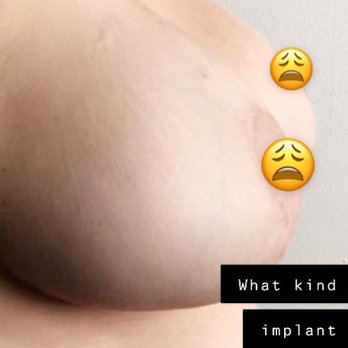 Taneja Arvin, MD - Cosmetic Surgeons Near Me - Pasadena, California Taneja Arvin, MD - Cosmetic Surgeons Near Me - Pasadena, California