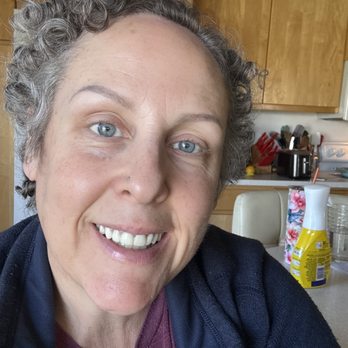 Ana Cluff, DDS - First day with upper dentures and feeling great! - Cosmetic Dentists Near Me - Lakeside, California