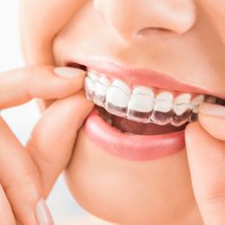 Bright Day Orthodontics - Tooth Aligners