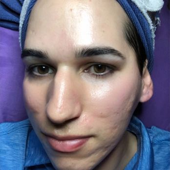 Clarity Spa - Me after a dermaplane treatment and gold facial mask - Skin Care Near Me - League City Tx, Alabama