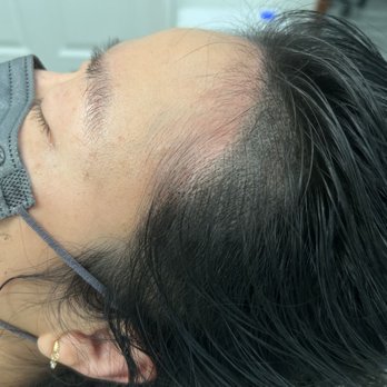 Lai PMU Beauty - After - Permanent Makeup Near Me - Arcadia, California Lai PMU Beauty - After - Permanent Makeup Near Me - Arcadia, California