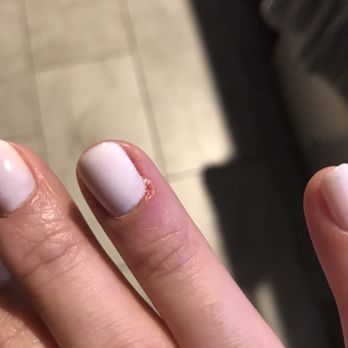 Miki Nail Bar - flesh cut off from my cuticle - Nail Salons Near Me - Las Vegas, Nevada