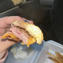 The Stand - Raw meat, hair
