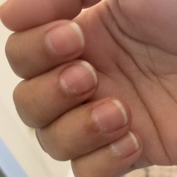 DMG Nails - Ruined nail beds - Nail Salons Near Me - Livonia, Michigan