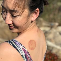Pearl Acupuncture