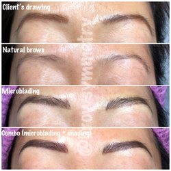 Brow Symmetry