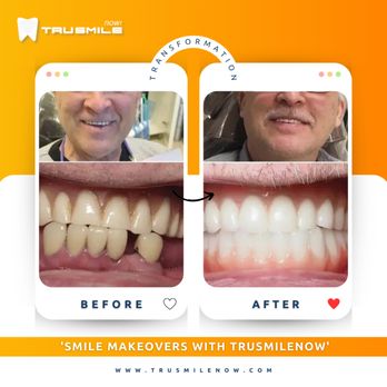 TruSmile Now - General Dentistry Near Me - Peoria, Arizona TruSmile Now - General Dentistry Near Me - Peoria, Arizona