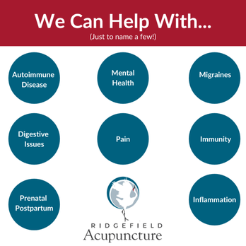 Ridgefield Acupuncture - Just a smidge of what we can offer! - Acupuncture Near Me - Ridgefield, Washington Ridgefield Acupuncture - Just a smidge of what we can offer! - Acupuncture Near Me - Ridgefield, Washington
