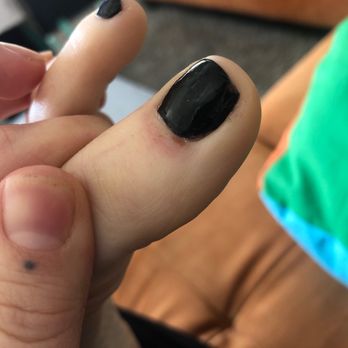 Ava Nails & Spa - Cuts on cuticles - Nail Salons Near Me - Antelope, California