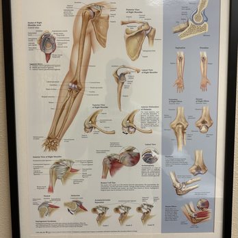 Simonian Sports Medicine Clinic - I liked seeing what was going on via these diagrams too. Very helpful! - Sports Medicine Near Me - Clovis, California Simonian Sports Medicine Clinic - I liked seeing what was going on via these diagrams too. Very helpful! - Sports Medicine Near Me - Clovis, California