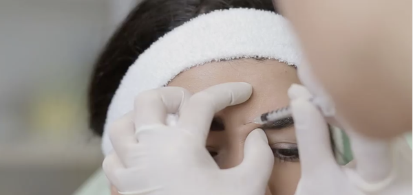 Botox - Regain that youthful look and make wrinkles a thing of the past. Botox works by relaxing of the facial muscles to help with wrinkles. $10.50/unit. Schedule your appointment today!