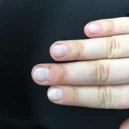 Uneven filing, sloppy uneven polish