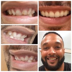 Healthiest of Smiles - One happy patient!