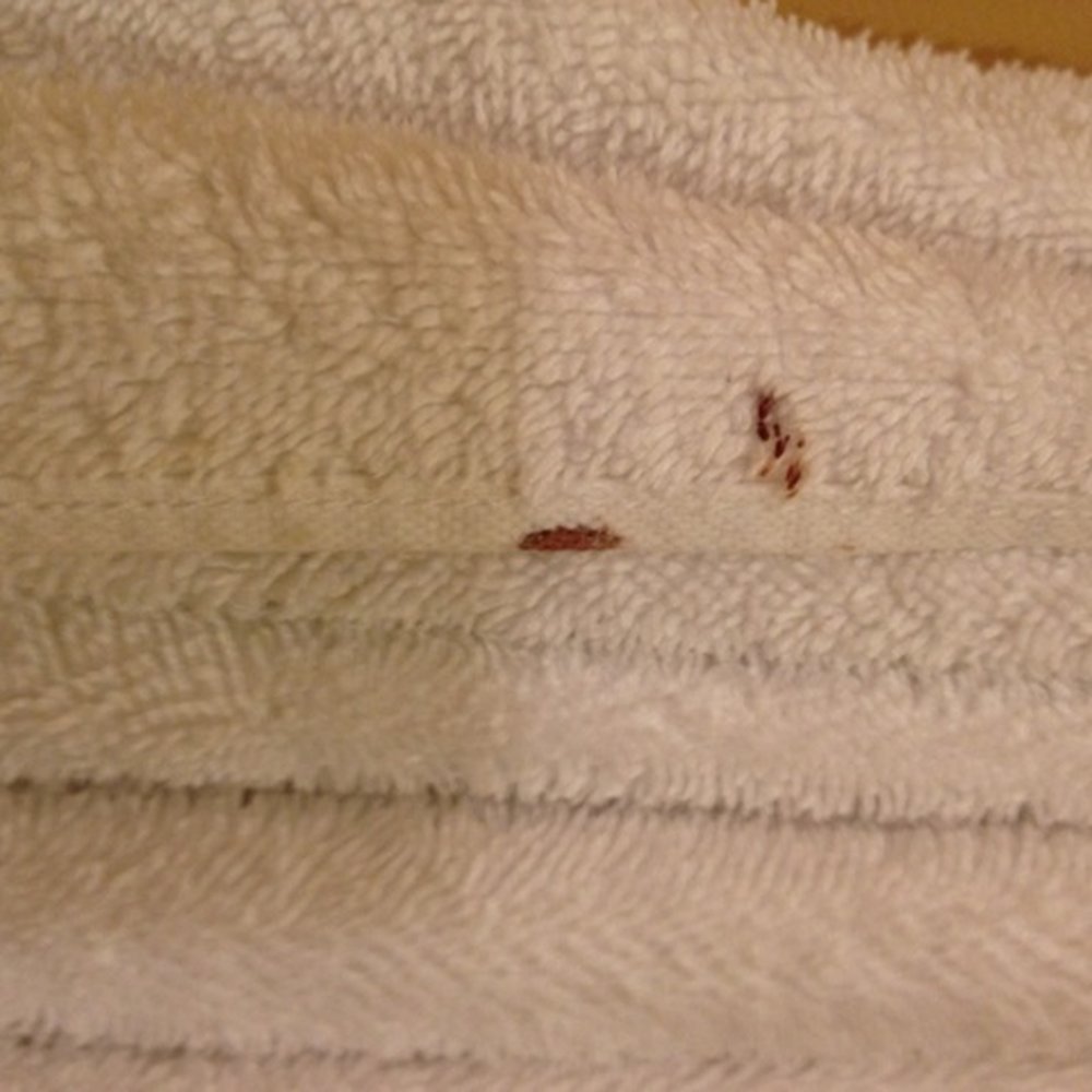 Kimpton Hotel Monaco Baltimore Inner Harbor - Unfolded a "fresh" towel for my son to take a shower. Ew. Mystery stains. - Hotels Near Me - Baltimore, Maryland Kimpton Hotel Monaco Baltimore Inner Harbor - Unfolded a "fresh" towel for my son to take a shower. Ew. Mystery stains. - Hotels Near Me - Baltimore, Maryland