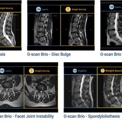 River Oaks Mri and Diagnostic - Beautiful MRI images on a weight bearing patient