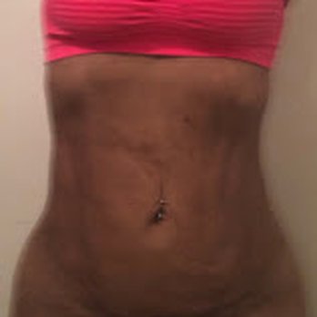 Avana Plastic Surgery - Cosmetic Surgeons Near Me - Miami, Florida
