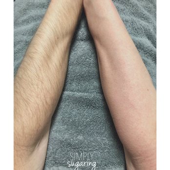 Simply Sugaring - Before and after - Waxing Near Me - Monticello, Indiana Simply Sugaring - Before and after - Waxing Near Me - Monticello, Indiana