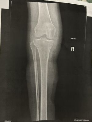 Everett Bone & Joint