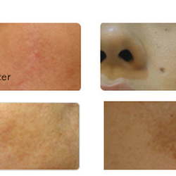 Taewon Moon MD - Laser Clinic & Plastic Surgery