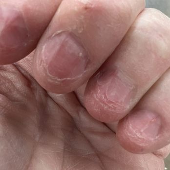 LS Nail Studio - my nails were in bad bad shape - Nail Salons Near Me - Santa Clarita, California