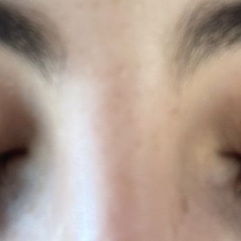 Amazing Lash Studio - so fake looking and eyelashes glued to lid on both sides - Eyelash Service Near Me - Chesterfield, Missouri Amazing Lash Studio - so fake looking and eyelashes glued to lid on both sides - Eyelash Service Near Me - Chesterfield, Missouri