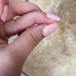 Only been 2 days and it's already peeling