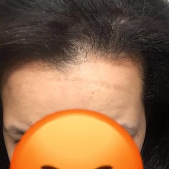 Tenth Street Hair Lounge - The hair dye left on my forehead by Janell - Hair Salons Near Me - Riverside, California Tenth Street Hair Lounge - The hair dye left on my forehead by Janell - Hair Salons Near Me - Riverside, California