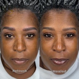 Look at the different , from healing to the retouch. All I can say is I got my Sexy back... Look at the different , from healing to the retouch. All I can say is I got my Sexy back...