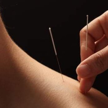 Refresh Massage Therapy Mississauga - Acupuncture treatments - Massage Therapy Near Me - Mississauga, Ontario Refresh Massage Therapy Mississauga - Acupuncture treatments - Massage Therapy Near Me - Mississauga, Ontario