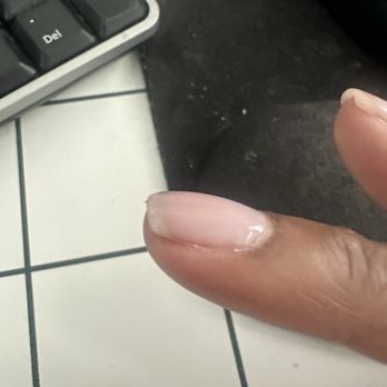 River Oak Nails & Spa - Dry skin on the side is of nail - Nail Salons Near Me - Houston, Texas River Oak Nails & Spa - Dry skin on the side is of nail - Nail Salons Near Me - Houston, Texas