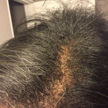 BVH Glam Studios - Normal density of my hair - Hair Extensions Near Me - North Hollywood, California BVH Glam Studios - Normal density of my hair - Hair Extensions Near Me - North Hollywood, California